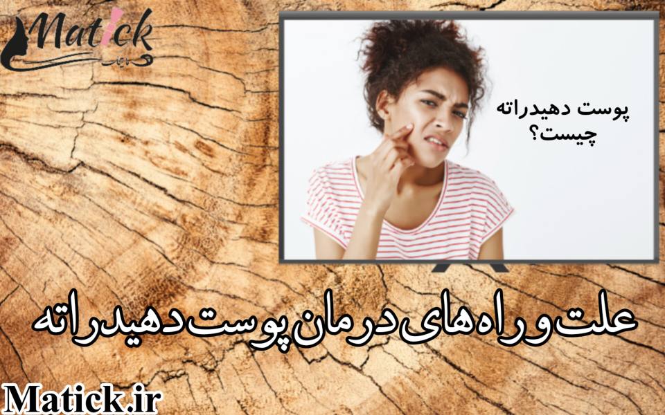 پوست دهیدراته چیست و چه خطراتی برای ما دارد؟ علت و راه های درمان پوست دهیدراته