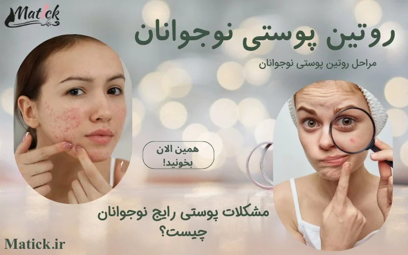 درمان مشکلات پوستی رایج نوجوانان با روتین پوستی