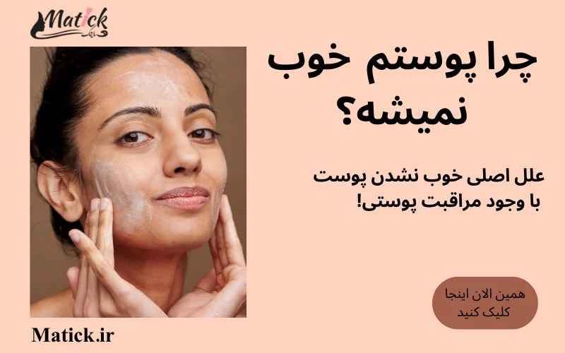 چرا پوستم خوب نمیشه؟ علل درمان و موارد دیگر